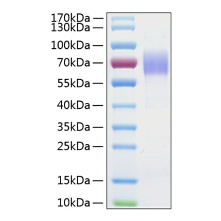 SDS-PAGE - Recombinant Human CD204 Protein (C-terminal His Tag) (A330263) - Antibodies.com
