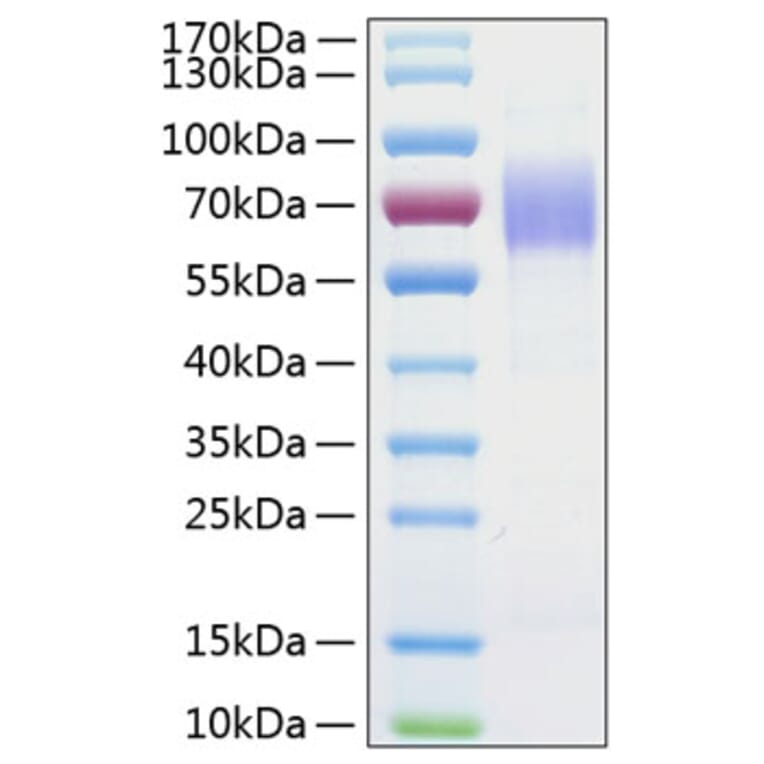 SDS-PAGE - Recombinant Human CD204 Protein (C-terminal His Tag) (A330263) - Antibodies.com