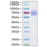 SDS-PAGE - Recombinant Human CD204 Protein (C-terminal His Tag) (A330263) - Antibodies.com