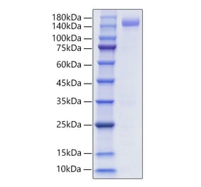 SDS-PAGE - Recombinant Human CD22 Protein (C-terminal Human Fc and His Tag) (A330264) - Antibodies.com