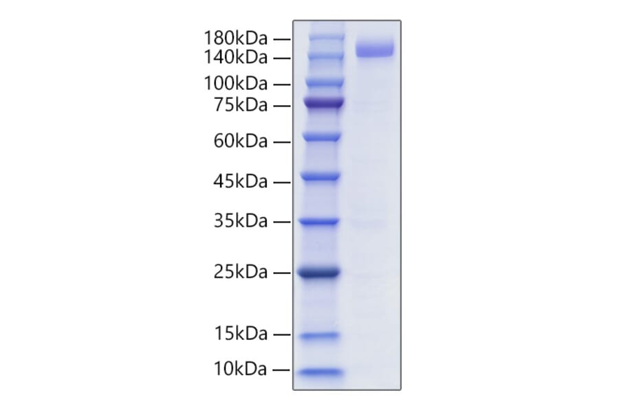 SDS-PAGE - Recombinant Human CD22 Protein (C-terminal Human Fc and His Tag) (A330264) - Antibodies.com