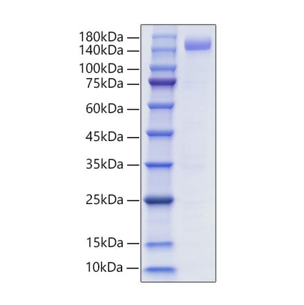 SDS-PAGE - Recombinant Human CD22 Protein (C-terminal Human Fc and His Tag) (A330264) - Antibodies.com