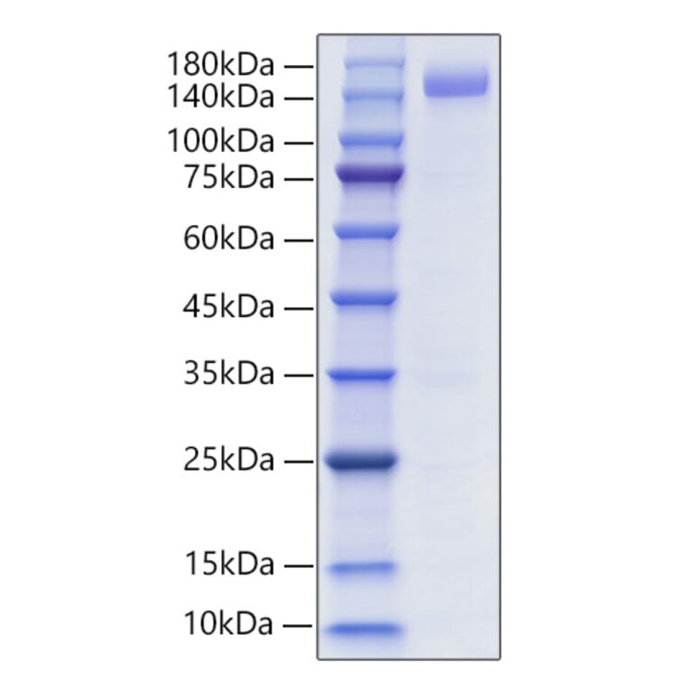 SDS-PAGE - Recombinant Human CD22 Protein (C-terminal Human Fc and His Tag) (A330264) - Antibodies.com