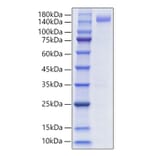SDS-PAGE - Recombinant Human CD22 Protein (C-terminal Human Fc and His Tag) (A330264) - Antibodies.com