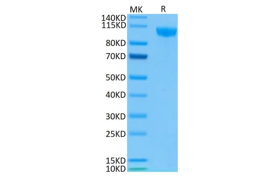 Tris-Bis PAGE - Recombinant Human CD22 Protein (Biotin) (C-terminal His and Avi Tag) (A330265) - Antibodies.com