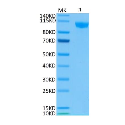 Tris-Bis PAGE - Recombinant Human CD22 Protein (Biotin) (C-terminal His and Avi Tag) (A330265) - Antibodies.com