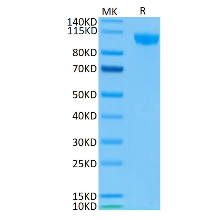 Tris-Bis PAGE - Recombinant Human CD22 Protein (Biotin) (C-terminal His and Avi Tag) (A330265) - Antibodies.com