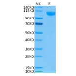Tris-Bis PAGE - Recombinant Human CD22 Protein (Biotin) (C-terminal His and Avi Tag) (A330265) - Antibodies.com