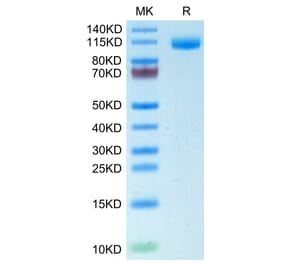 Tris-Bis PAGE - Recombinant Human CD22 Protein (C-terminal His Tag) (A330266) - Antibodies.com