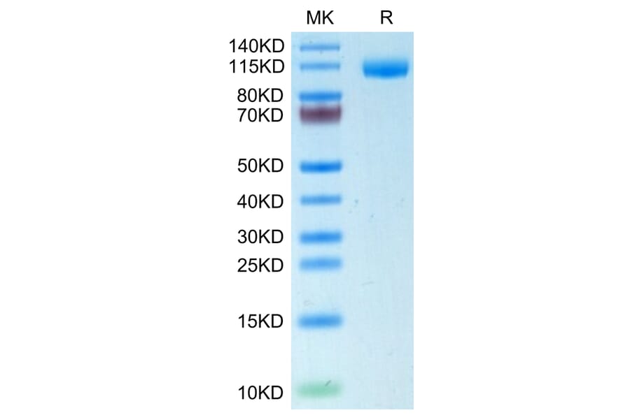 Tris-Bis PAGE - Recombinant Human CD22 Protein (C-terminal His Tag) (A330266) - Antibodies.com