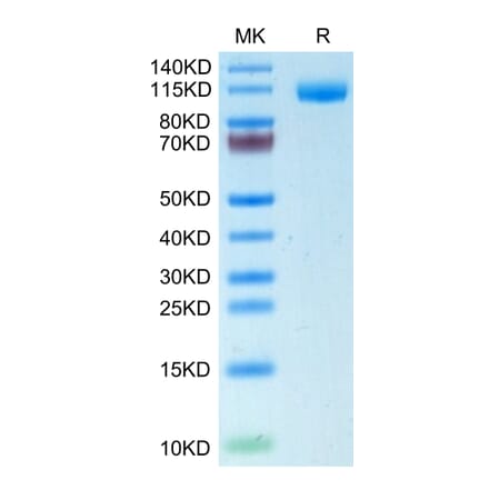 Tris-Bis PAGE - Recombinant Human CD22 Protein (C-terminal His Tag) (A330266) - Antibodies.com