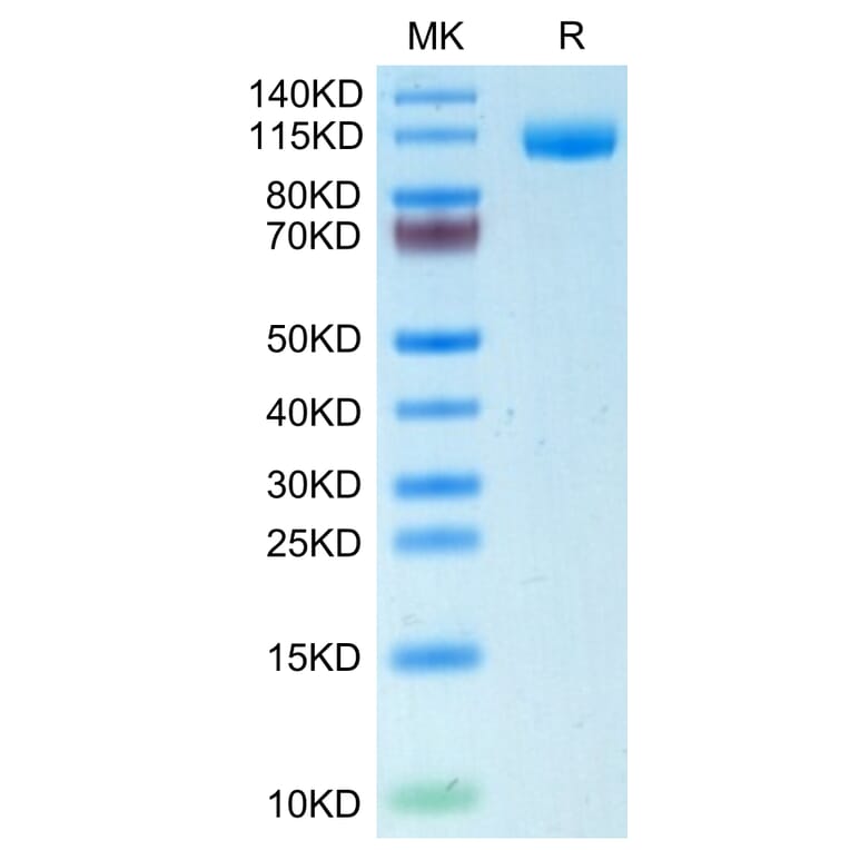 Tris-Bis PAGE - Recombinant Human CD22 Protein (C-terminal His Tag) (A330266) - Antibodies.com