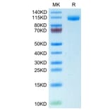 Tris-Bis PAGE - Recombinant Human CD22 Protein (C-terminal His Tag) (A330266) - Antibodies.com
