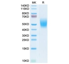 Tris-Bis PAGE - Recombinant Cynomolgus macaque CD226 Protein (C-terminal His Tag) (A330267) - Antibodies.com