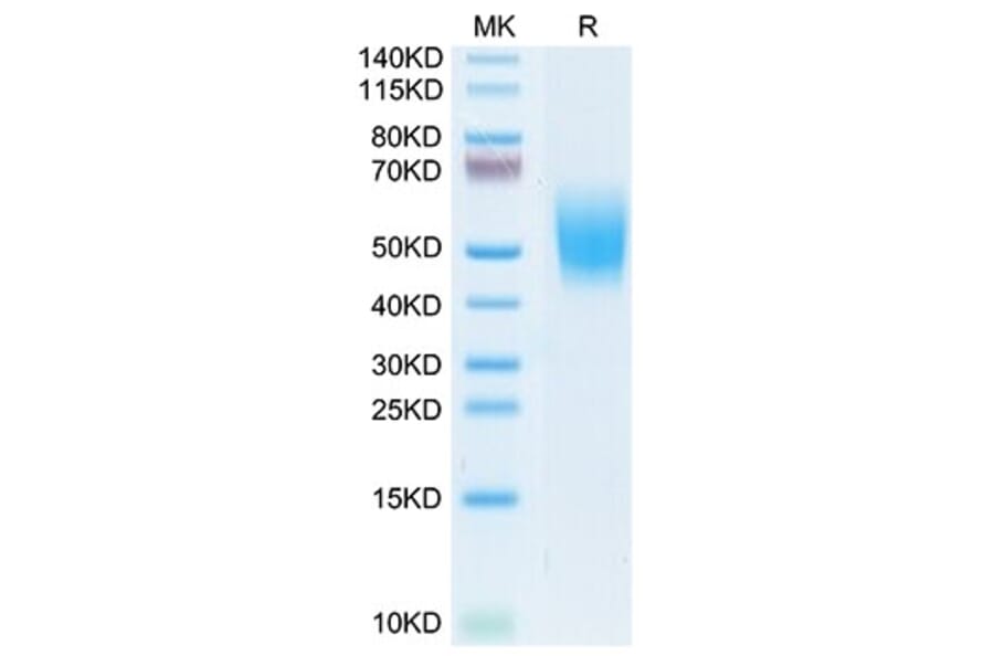 Tris-Bis PAGE - Recombinant Cynomolgus macaque CD226 Protein (C-terminal His Tag) (A330267) - Antibodies.com