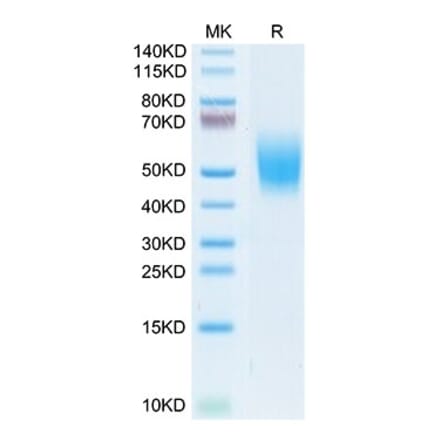 Tris-Bis PAGE - Recombinant Cynomolgus macaque CD226 Protein (C-terminal His Tag) (A330267) - Antibodies.com