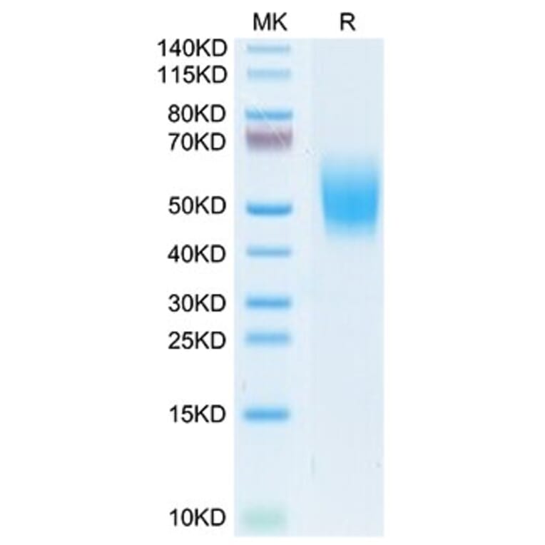 Tris-Bis PAGE - Recombinant Cynomolgus macaque CD226 Protein (C-terminal His Tag) (A330267) - Antibodies.com