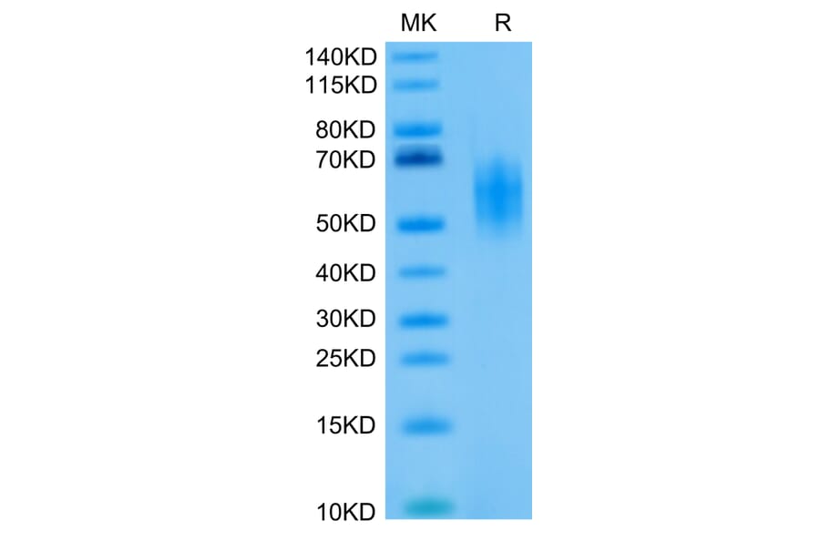Tris-Bis PAGE - Recombinant Human CD226 Protein (Biotin) (C-terminal His and Avi Tag) (A330268) - Antibodies.com