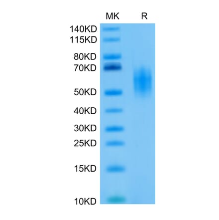 Tris-Bis PAGE - Recombinant Human CD226 Protein (Biotin) (C-terminal His and Avi Tag) (A330268) - Antibodies.com
