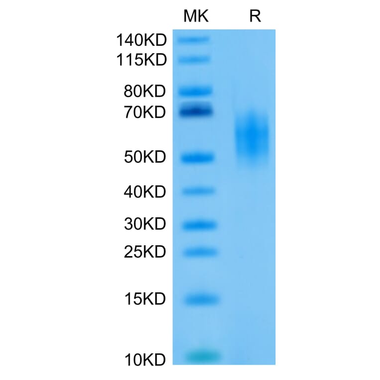 Tris-Bis PAGE - Recombinant Human CD226 Protein (Biotin) (C-terminal His and Avi Tag) (A330268) - Antibodies.com