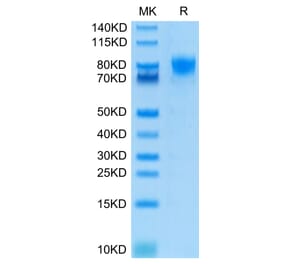 Tris-Bis PAGE - Recombinant Human CD226 Protein (C-terminal Human Fc Tag) (A330269) - Antibodies.com