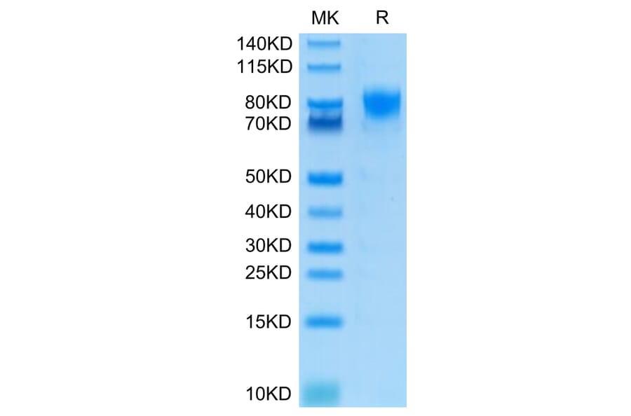 Tris-Bis PAGE - Recombinant Human CD226 Protein (C-terminal Human Fc Tag) (A330269) - Antibodies.com