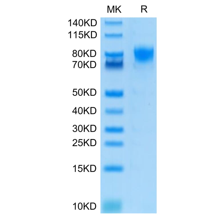 Tris-Bis PAGE - Recombinant Human CD226 Protein (C-terminal Human Fc Tag) (A330269) - Antibodies.com