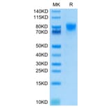 Tris-Bis PAGE - Recombinant Human CD226 Protein (C-terminal Human Fc Tag) (A330269) - Antibodies.com