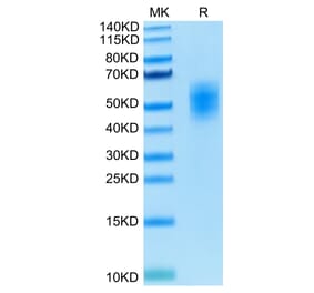 Tris-Bis PAGE - Recombinant Human CD226 Protein (C-terminal His and Avi Tag) (A330270) - Antibodies.com