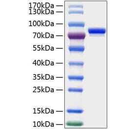 SDS-PAGE - Recombinant Human CD229 Protein (C-terminal His Tag) (A330271) - Antibodies.com