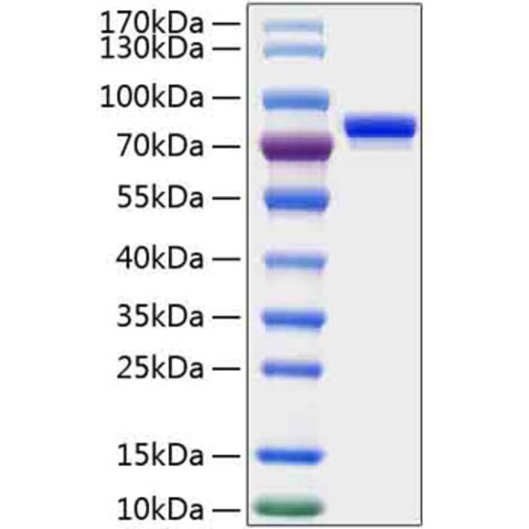 SDS-PAGE - Recombinant Human CD229 Protein (C-terminal His Tag) (A330271) - Antibodies.com