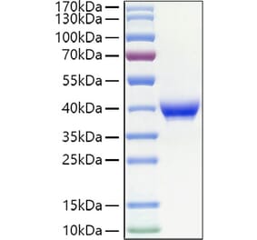 SDS-PAGE - Recombinant Human CD23 Protein (N-terminal His Tag) (A330272) - Antibodies.com