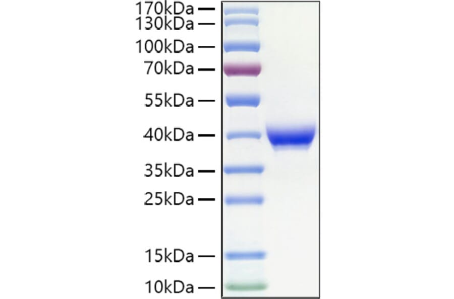 SDS-PAGE - Recombinant Human CD23 Protein (N-terminal His Tag) (A330272) - Antibodies.com