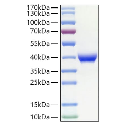 SDS-PAGE - Recombinant Human CD23 Protein (N-terminal His Tag) (A330272) - Antibodies.com