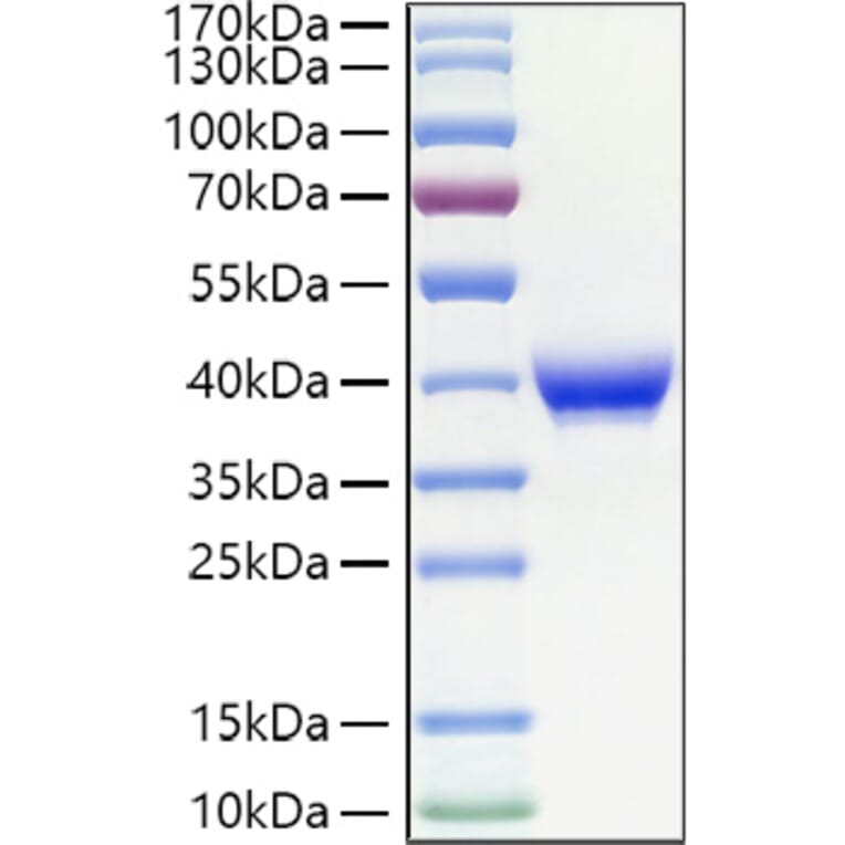 SDS-PAGE - Recombinant Human CD23 Protein (N-terminal His Tag) (A330272) - Antibodies.com