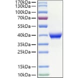 SDS-PAGE - Recombinant Human CD23 Protein (N-terminal His Tag) (A330272) - Antibodies.com
