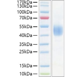 SDS-PAGE - Recombinant Mouse CD24 Protein (C-terminal Human Fc Tag) (A330273) - Antibodies.com