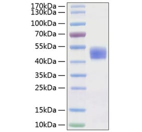 SDS-PAGE - Recombinant Human CD24 Protein (C-terminal Human Fc Tag) (A330274) - Antibodies.com