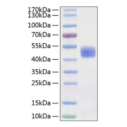 SDS-PAGE - Recombinant Human CD24 Protein (C-terminal Human Fc Tag) (A330274) - Antibodies.com