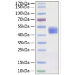 SDS-PAGE - Recombinant Human CD24 Protein (C-terminal Human Fc Tag) (A330274) - Antibodies.com