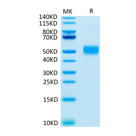 Tris-Bis PAGE - Recombinant Human CD24 Protein (C-terminal Llama Fc Tag) (A330275) - Antibodies.com