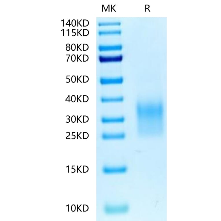 Tris-Bis PAGE - Recombinant Human CD24 Protein (Biotin) (C-terminal His and Avi Tag) (A330276) - Antibodies.com