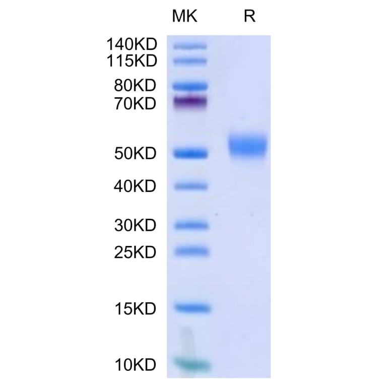 Tris-Bis PAGE - Recombinant Human CD24 Protein (Biotin) (C-terminal Human Fc Tag) (A330278) - Antibodies.com