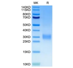 Tris-Bis PAGE - Recombinant Human CD24 Protein (C-terminal His and Avi Tag) (A330279) - Antibodies.com
