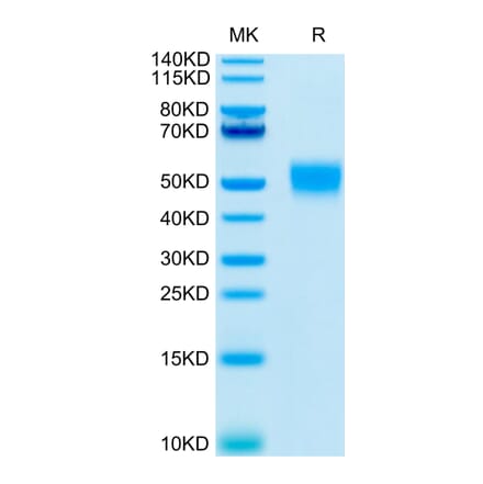 Tris-Bis PAGE - Recombinant Human CD24 Protein (C-terminal Mouse Fc Tag) (A330280) - Antibodies.com