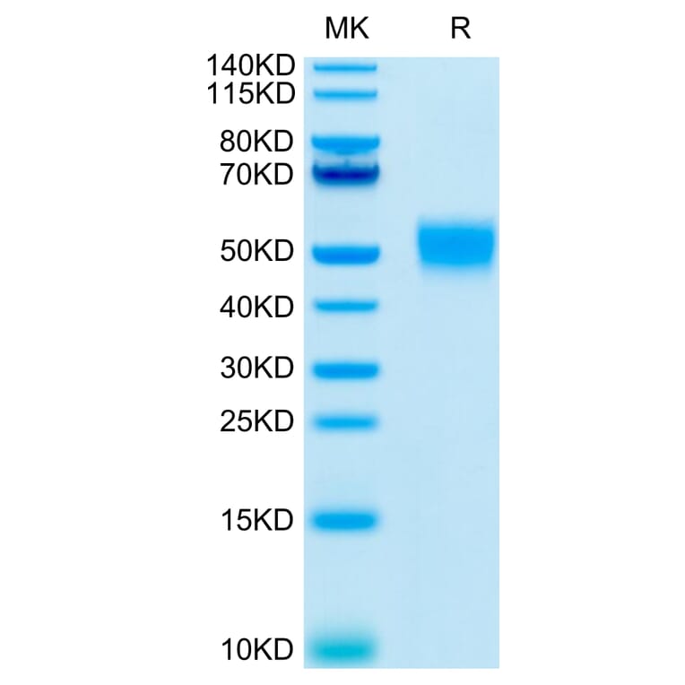 Tris-Bis PAGE - Recombinant Human CD24 Protein (C-terminal Mouse Fc Tag) (A330280) - Antibodies.com