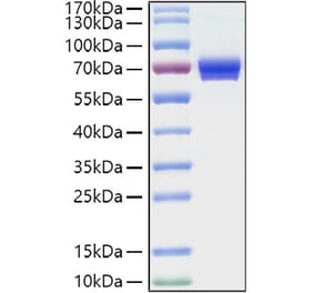 SDS-PAGE - Recombinant Human CD25 Protein (C-terminal Human Fc and His Tag) (A330282) - Antibodies.com