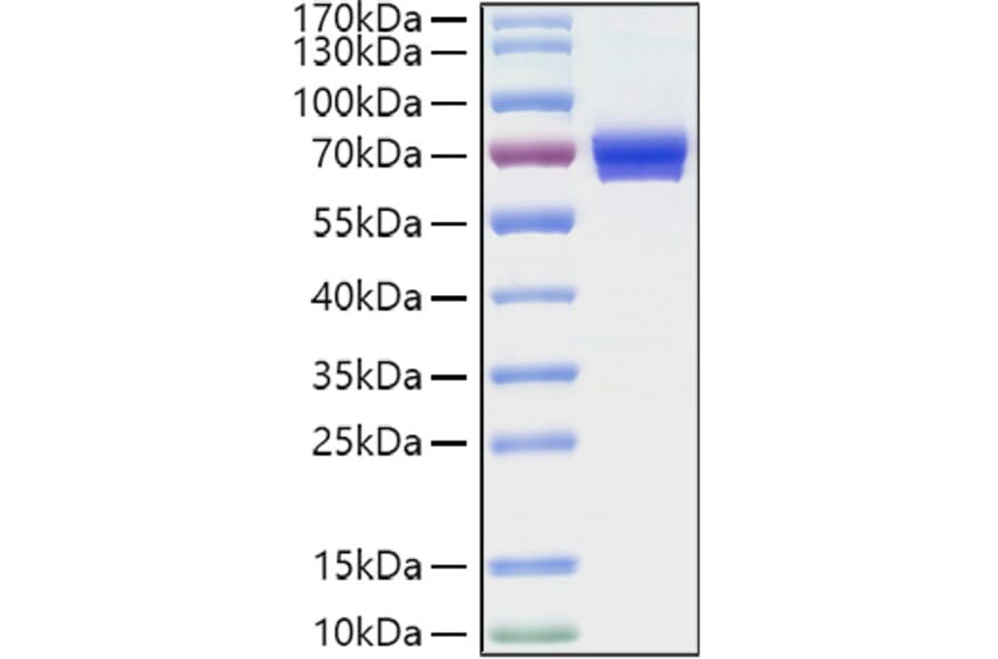 SDS-PAGE - Recombinant Human CD25 Protein (C-terminal Human Fc and His Tag) (A330282) - Antibodies.com