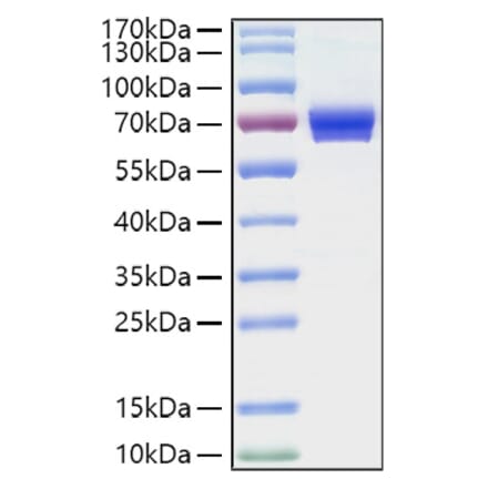 SDS-PAGE - Recombinant Human CD25 Protein (C-terminal Human Fc and His Tag) (A330282) - Antibodies.com