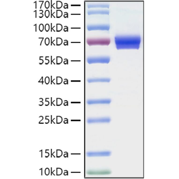 SDS-PAGE - Recombinant Human CD25 Protein (C-terminal Human Fc and His Tag) (A330282) - Antibodies.com